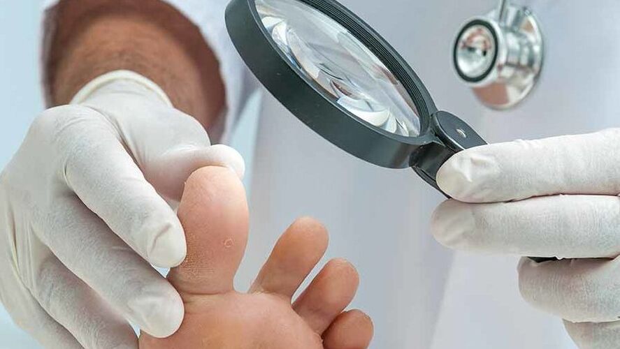 El diagnóstico de hongos en las uñas de los pies lo realiza un dermatólogo. 